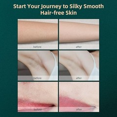 Laser Hair Removal JOVS Dora IPL Device for Women & Men