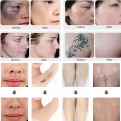 2in1 PRO OPT Elight IPL Laser Hair Removal RF Skin Rejuvenation Machine