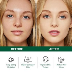 Tea Tree Salicylic Acid Facial Skin Care Set, Acne Treatment Skincare Set…