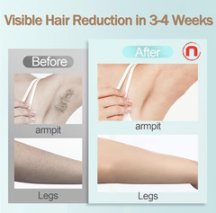 🪒✨ IPL Hair Removal Device 🪒✨