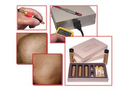 Bio Avance Non Laser Machine for Permanent Hair Removal, Chin Legs Chest Back *