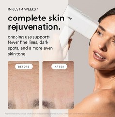 Nood™ NEW Flasher Pro + Slow-Grow Serum — 1 Count (Pack of 2), Gloss White