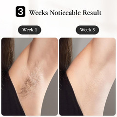 Laser Hair Removal, IPL Hair Removal for Women and Men, 37°F Painless Sapphire I