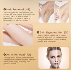Hair-Epilator 3-IN-1 Functions & 9 Energy Levels Hair Removal Machine For Body