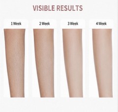 • IPL Hair Removal with Ice Cooling – Free Shipping