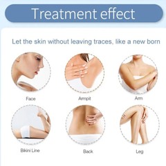 Ice Titanium Painless Permanent Hair Removal Diode Laser 755 808 1064nm Machine