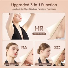 IPL Hair Removal Device
