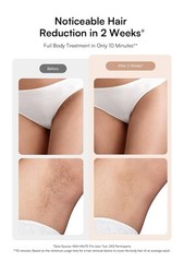 INIA HAUTE Pro IPL Laser Hair Removal Device – Painless Ice Cooling Care – Pink