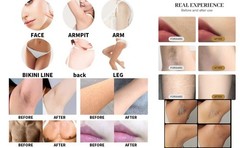 2IN1 755nm 808nm 1064nm Diode Laser Hair Removal Pico Tattoo ND YAG Machine