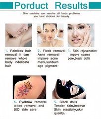 2-in-1 4000W Picosecond Laser&Diode Laser Spot Removal Salon Equipment