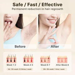 IPL Laser Hair Removal 999999 Flashes Permanent Hair Remover Women Men Face Body