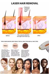 2in1 808 Diode Laser Hair & Picosecond Tattoo Removal Machine Yag 755 808 1064