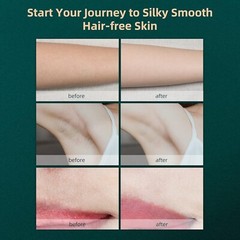 JOVS Dora IPL Hair Removal Device – Stepless Knob Shift, Touch Screen, Unlimited