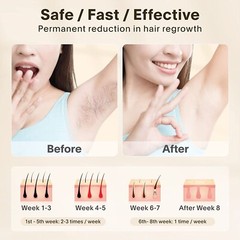 Laser Hair Removal for Women and Men IPL Hair Remover FREE SHIPPING