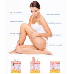 2024 Diode Laser 755nm 810nm 1064nm HAIR REMOVAL Body Skin Whitening Machine