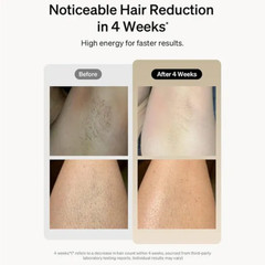 Professional Laser Epilator IPL Hair Removal Body Bikini Leg Depilatory Devic 90