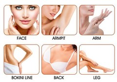 2026 Diode Laser Hair Removal Yag 755 808 1064 Diode Laser Hair Removal Machine