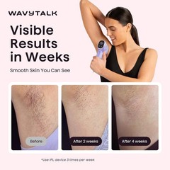 Painless IPL Hair Removal Device with Precision Roller for Face & Body, Corded