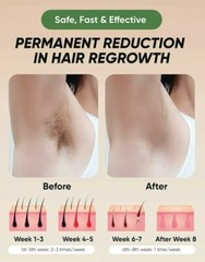 IPL Hair Removal for Women & Men Permanent Hair Removal 500,000 Flashes