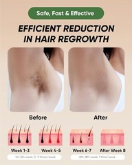 XSOUL At-Home IPL Hair Removal for Women and Men Hair Removal Painless Hair Remo