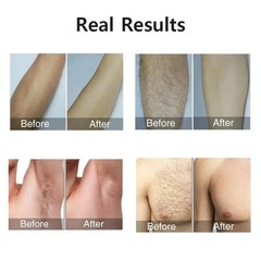 990000 Flashes Electric Depiladora Laser Permanent IPL Laser Hair Removal Device