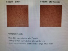 Home Permanent Hair Reduction Device by mē Sleek Iluminage Beauty HU-FG01421NA