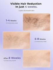 Ubroo 2026 Laser Hair Removal with 5℃ Ice Cooling, Hand-Held Shaving Device IPL