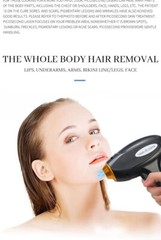 2in1 Q Switch Nd Yag Picosecond laser Tattoo Removal Diode Laser Hair Removal