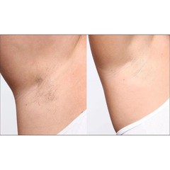 Silk’n BellaFlash Pro Hair Removal System NEW in Box – White