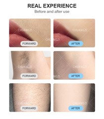 High-quality 755/808/1064nm laser hair removal device, painless hair removal.