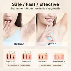 Laser Hair Removal IPL Device Painless LCD Permanent Home Beauty Tool