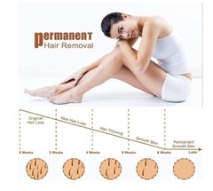 IPL Painless Permanent Hair Removal Hair Remover Whole Body Use – Black
