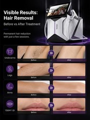 Mecavie 2-in-1 Dual Probe FAC 4-Wave Salon Pigment Conditioning Machine 4000W