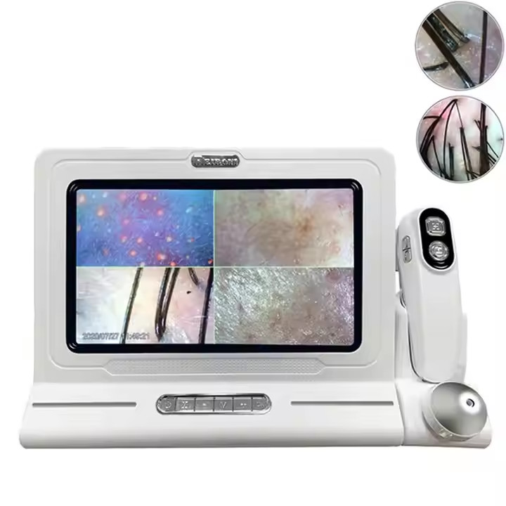 Hair Follicle Scalp Test Scanner Detector Hair/Skin/Scalp Hair Analysis Machine