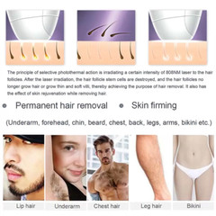 Diode Laser 755 808 1064nm Permanent Painless Body Face Hair Removal Machine