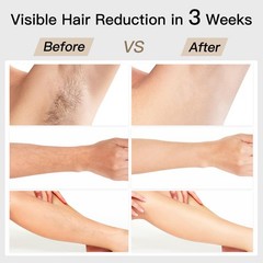 Laser Hair Removal, BoSidin IPL Removal with 200*127*52 mm, Green