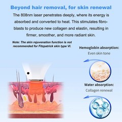 Diode 808nm Painless Laser Hair Removal Machine 3 months Permanent Hair Removal