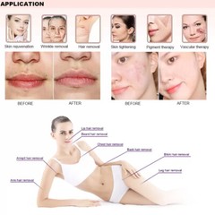 Painless IPL/OPT Hair Removal Laser Skin Rejuvenation Pigment Removal Machine
