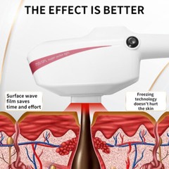 Painless IPL Laser Hair Removal Skin Rejuvenation Laser Hair Removal Machine