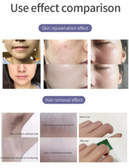 IPL OPT DPL Hair Removal Machine Laser Skin Rejuvenation Acne Vascular Removal