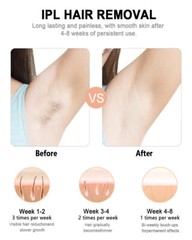 MEUKPE IPL Laser Hair Removal Device Pulsar Series for Women Men