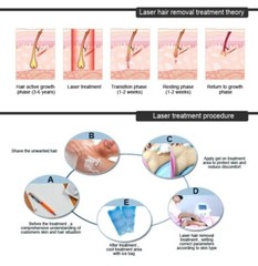 755nm+808nm+1064nm 2IN1 Diode Laser Hair Tattoo Removal Pico Yag Laser Machine