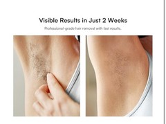 At-home IPL Hair Remover for Women/Men Permanent Armpits Back Legs Arms Face
