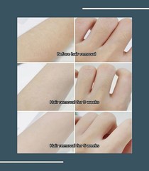 Professional 755 808 940 1064NM 4 Wavelength Diode Laser Hair Removal Device