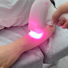 Professional 2026 ICE Titanium 755/808/1064 Diode Laser Hair Removal System