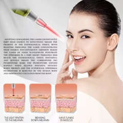 2In1 Diode Laser Hair Removal ND YAG Picosecond Tattoo Removal Skin Care Machine