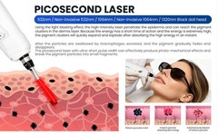 2 In 1 808nm Diode Laser Hair Removal & Pico Laser Tattoo removal Machine 10bar