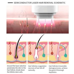 1064nm/755nm/808nm Diode Laser Body Hair Removal Permanent Machine Body & Facial