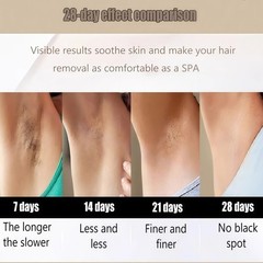 Portable permanent diode laser hair removal machine 755/808/940/1064nm