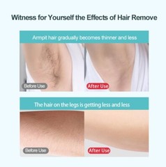 IPL Laser/Light Hair Removal see result in weeks
